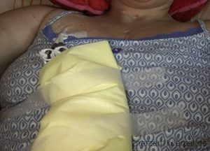 Letzter Ausweg war der Demerskatheter im rechten Vorhof